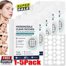 5x Curalona Microneedle Patches 144pcs, Skin Tag Wart Acne Remover Patches Hot