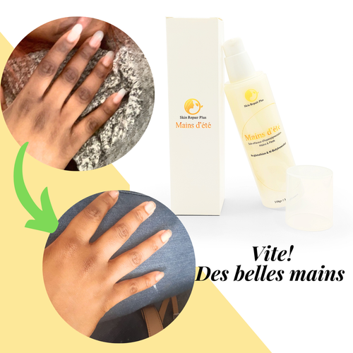 Crème SOIN Effaceur d'hyperpigmentation pour phalanges, pieds - Zdjęcie 2 z 17