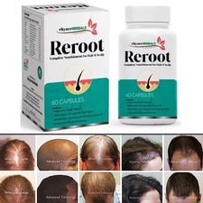 DHT BLOCKER Herbal HAIR Fast GROWTH PILLS Prevent Anti Loss Stimulate Fuller