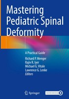 Mastering Pediatric Spinal Deformity | A Practical Guide | Menger (U. A.) | Buch