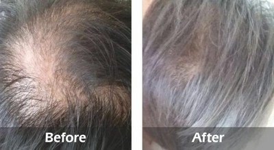 Divine Herbal Hair Oil for hair growth - helps to reduce hair loss & Alopecia | eBay Divine Herbal Hair Oil for hair growth - helps to reduce hair loss & Alopecia | eBay