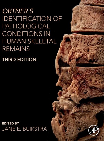 Ortner's Identification Of Pathological Conditions In Human Skeletal Remains-image