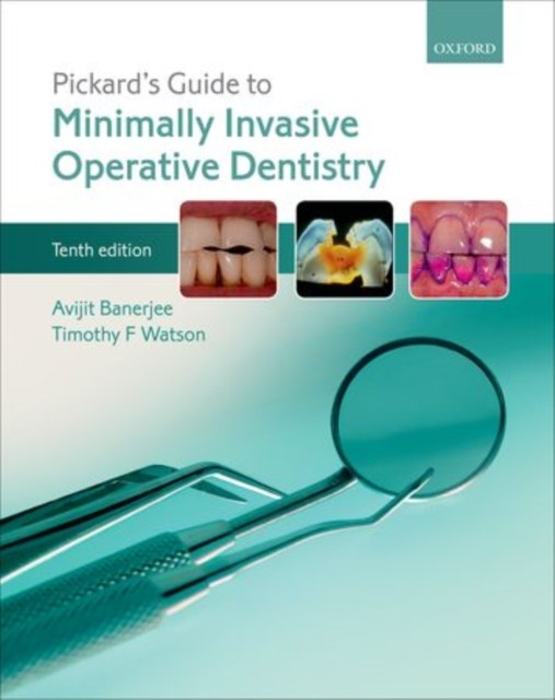 Pickards Guide To Minimally Invasive Ope