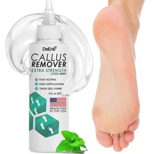 Callus Remover for Feet, Extra Strength Foot 8 Fl Oz (Pack of 1), Clear 