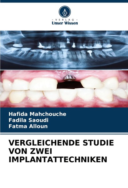 Hafida Mahchouche (U. A.) | Vergleichende Studie VON Zwei Implantattechniken-image