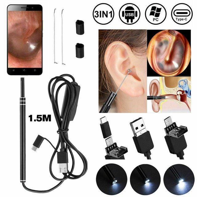 Digital Led Otoscope Ear Camera Scope Earwax Removal Kit Ear Wax