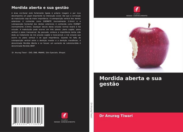 Mordida Aberta E Sua GestãO Anurag Tiwari-image