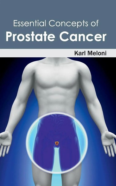 Karl Meloni | Essential Concepts Of Prostate Cancer | Buch | Englisch (2015)-image