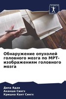 Obnaruzhenie Opuholej Golownogo Mozga Po Mrt-Izobrazheniqm Golownogo Mozga Buch