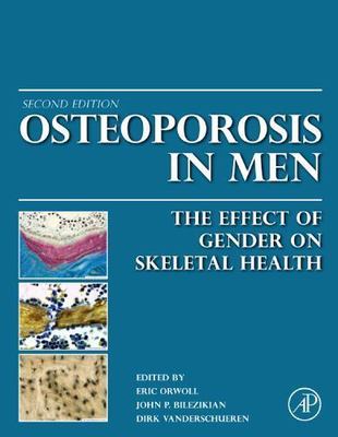 Osteoporosis in Men: The Effects of Gender on Skeletal Health