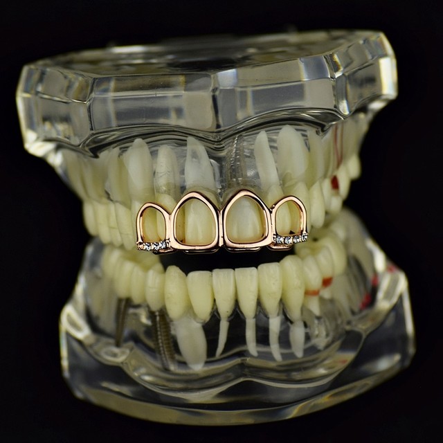 14k Rose Gold Plated Grillz All 4 Four Open Face Upper Top Teeth Hip