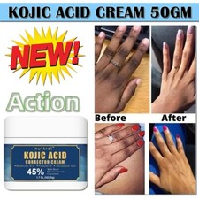 Strong Whitening Cream For Intimate Areas  Dark Knuckle Finger Elbow and Knee