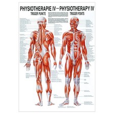 Triggerpunkte Poster Anatomie 70x50 cm medizinische Lehrmittel