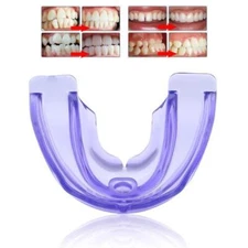 Myobrace Tooth Orthodontics Braces Veneers Anti Molar