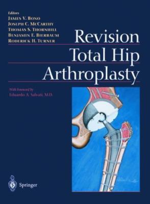Revision Total Hip Arthroplasty ,1999 Hardcover great shape