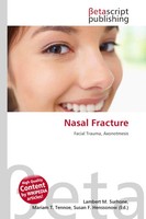 Lambert M. Surhone (U. A.) | Nasal Fracture | Taschenbuch | Englisch (2026)