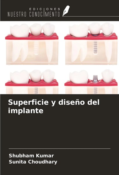 Superficie Y DiseñO Del Implante Shubham Kumar (U. A.) Taschenbuch Spanisch 2024-image