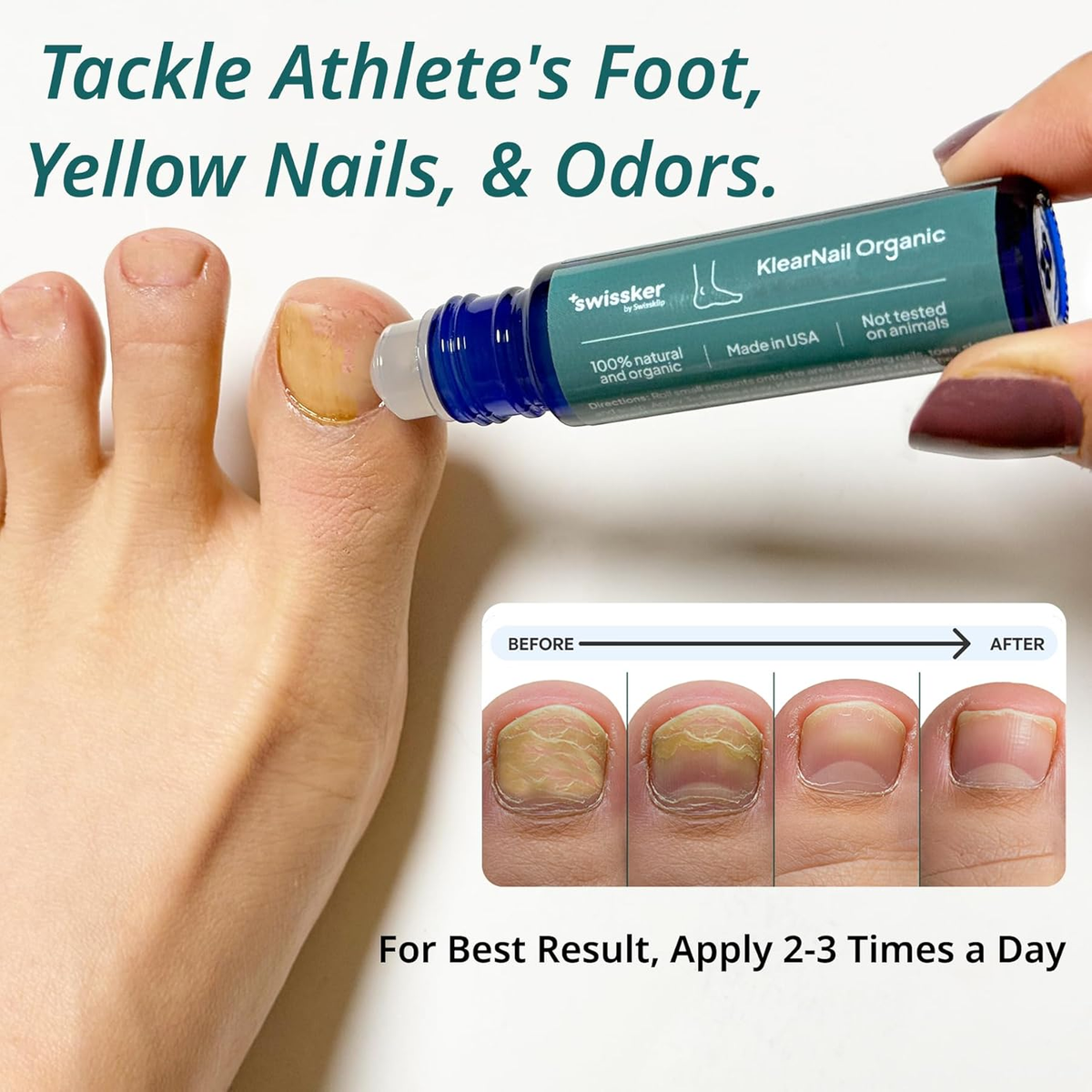 Klearnail Toenail Stick | Medi-Care Treatment | Natural Solution