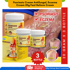 3 x Psoriasis Cream Antifungal cream Eczema Cream 20g Fast Relieve Cream