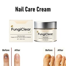 Nail Fungus Cream Restorative Nail Repair for Damaged Nails -Strengthens Nails