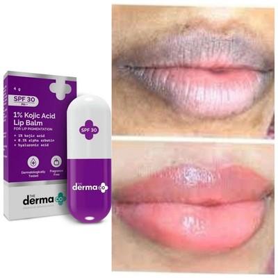 The Derma Co 1% Kojic Acid Lip Balm 4g Dark Pigmented Lips Free Shipping
