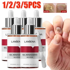 LANBENA Nail Repair Essence Remove Onychomycosis Serum Fungal Treatment Toe