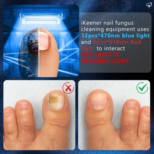 Nail Fungus Cleaning Laser Device Time Display 470nm Blue Lightand 910nm Repa... - Picture 6 of 8