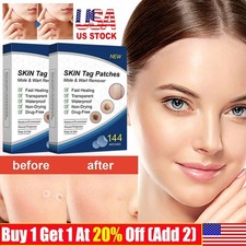720PC Skin Tag Remover Patches Quick Effective Mole and Wart Pad Removal Sticker