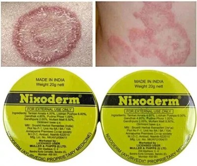 Menge 3 x Nixoderm Salbe je 20 g für Hautprobleme Bester Preis