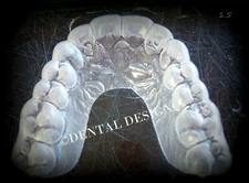 Custom Professional Fit THIN SOFT Night Bite Guard Teeth Grinding Comfortable  