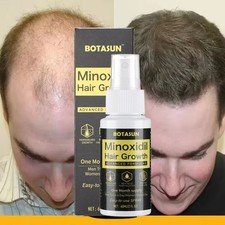 Minoxidil 5 Hair Growth Spray Serum Men Hair Loss Treatment 1 Month Supply 60ML
