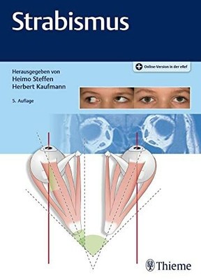 Strabismus: Plus Online-Version in der eRef Buch Thieme