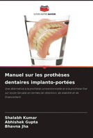 Shalabh Kumar (U. A.) | Manuel Sur Les ProthèSes Dentaires Implanto-PortéEs