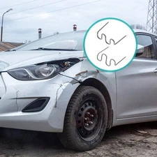 400pcs Hot Staple Repair Machine Welding Rod Car Bumper Repair Wave Staples