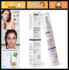 Dark Spot Remover for Face - Corrector for Age Spots, Freckles, Melasma, Natural