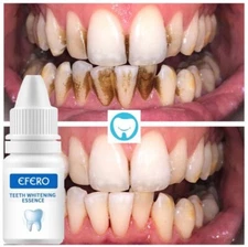Teeth Whitening Essence Serum Gel Remove Plaque Natural Tooth Whitening Powder