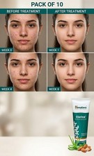 Clarina Face Wash by Himalaya - Herbal Oil Control  Clear Skin - Pack of