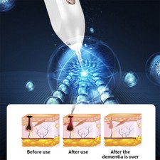 USB Skin Tag Removal Pen Mole Freckle Remover Winter Facial Spot Dark Spot Care