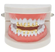 Custom Fit Mold At Home 14K Gold Plated Top & Bottom Caps Teeth Drip Grillz Set