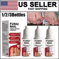 Fungi Nail Anti Fungal Liquid Formula Nail Repair Liquid Solution