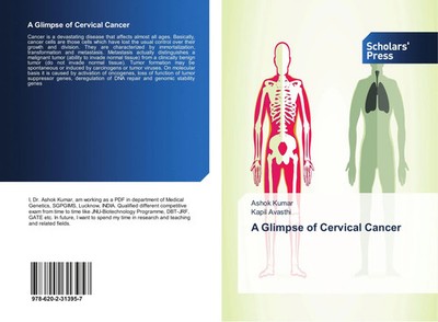 Ashok Kumar (u. a.) | A Glimpse of Cervical Cancer | Taschenbuch | Englisch
