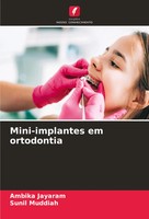 Ambika Jayaram (U. A.) | Mini-Implantes Em Ortodontia | Taschenbuch (2024)