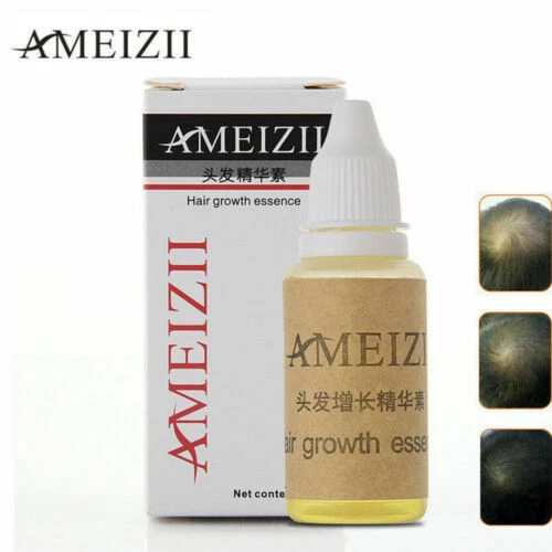 Oil Hair Loss Prevention Hair Loss Treatments