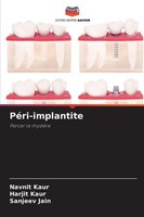 PéRi-Implantite, Navnit Kaur