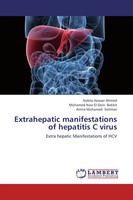 Nabila Hassan Ahmed (U. A.) | Extrahepatic Manifestations Of Hepatitis C Virus