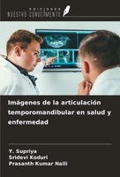 ImáGenes De La ArticulacióN Temporomandibular En Salud Y Enfermedad Taschenbuch