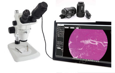 Hd 8 0mp Usb Digital Electronic Camera Eyepiece Microscope Telescope W Adapter Ebay