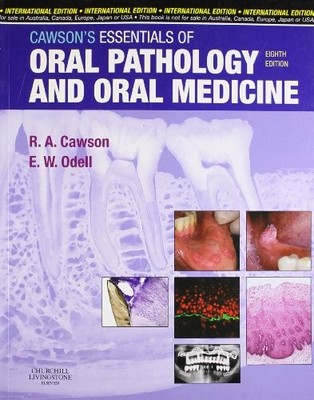 CAWSON'S ESSENTIALS OF ORAL PATHOLOGY AND ORAL MEDICINE By Roderick A. Cawson