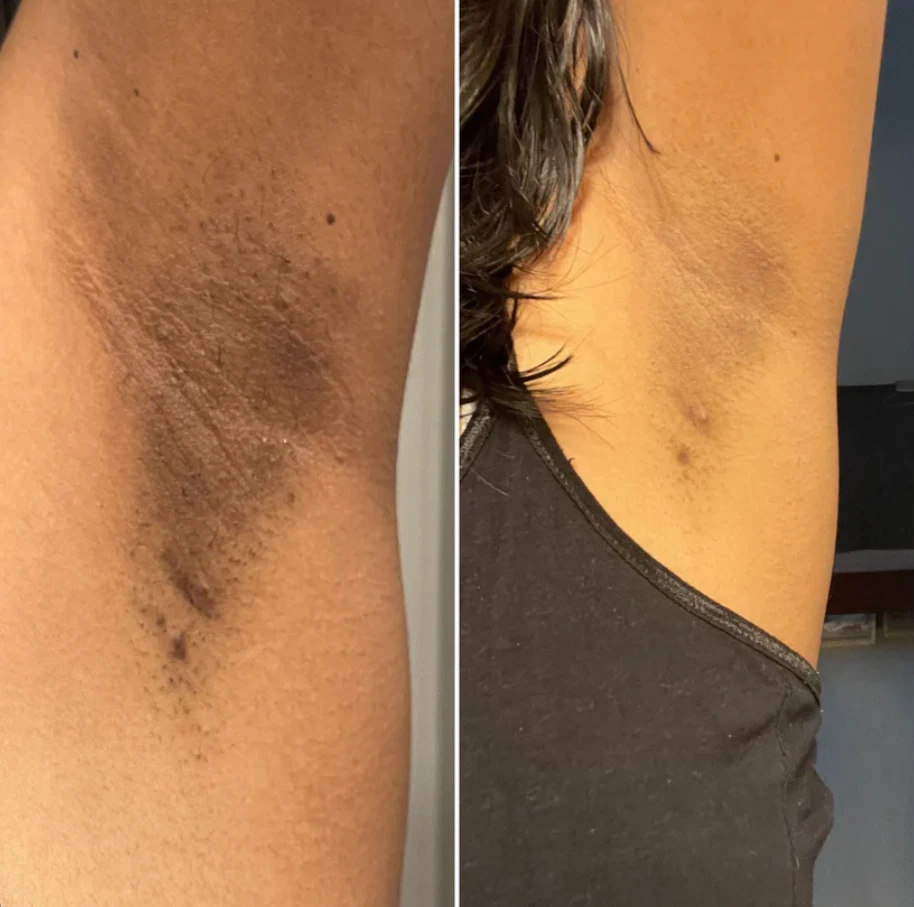 ēra exfoliating gel - Image 4 of 4