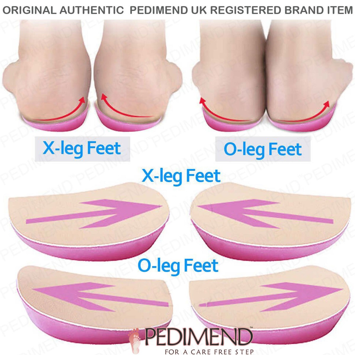 Pedimend™ Knock-Knees, Bow Legs, O/X Type Legs Corrective Insoles